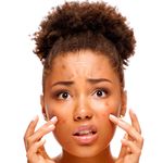 shutterstock_pimples
